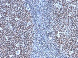 Cyclin B1 Antibody (SPM619), Novus Biologicals 0.2mg; Unlabeled:Antibodies,